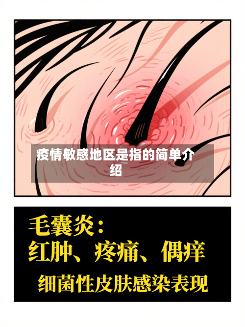 疫情敏感地区是指的简单介绍-第2张图片