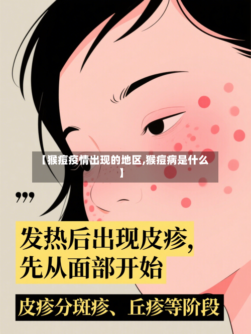 【猴痘疫情出现的地区,猴痘病是什么】-第3张图片